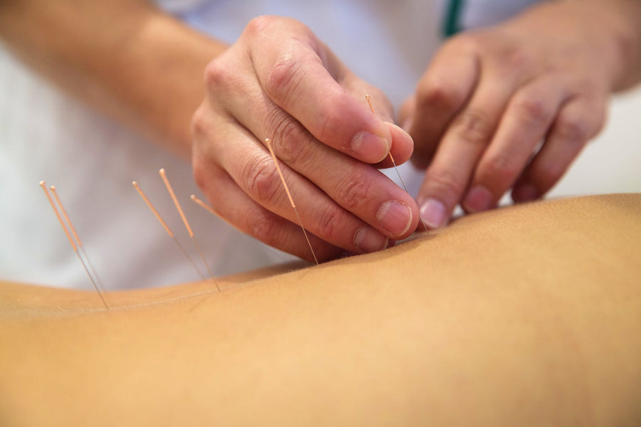 Which Diseases Can be Helped by Acupuncture?