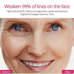 Argireline Collagen Peptide Wrinkle Serum Pro